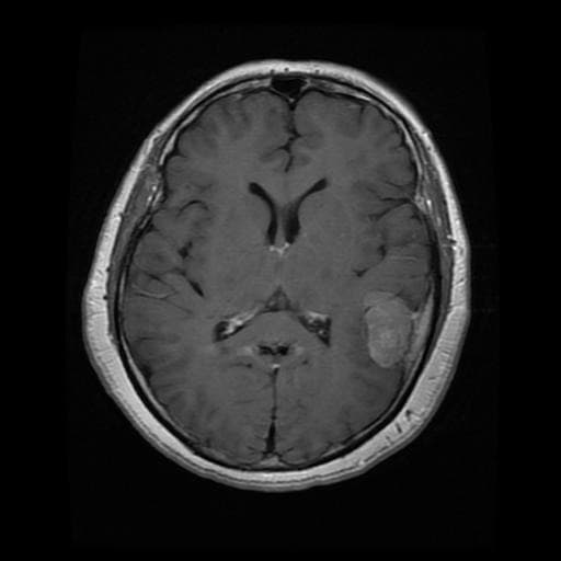MRI Sample 1