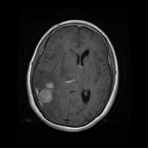 MRI Sample 2